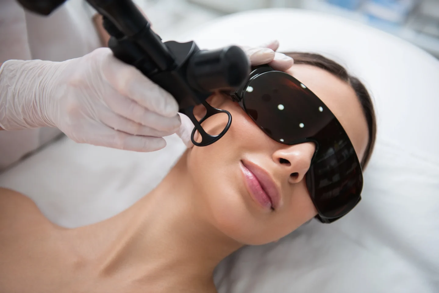 Advanced Profound RF and laser resurfacing at Cheeky Medspa