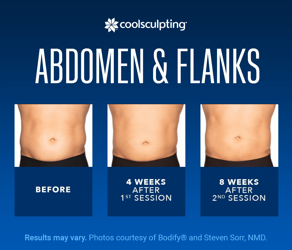 Fairbanks Body Contouring Case Thumbnail